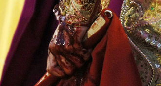 Imagen de la mano de Talavante tras cortarse en Baza. (Foto: Glez. Arjona)