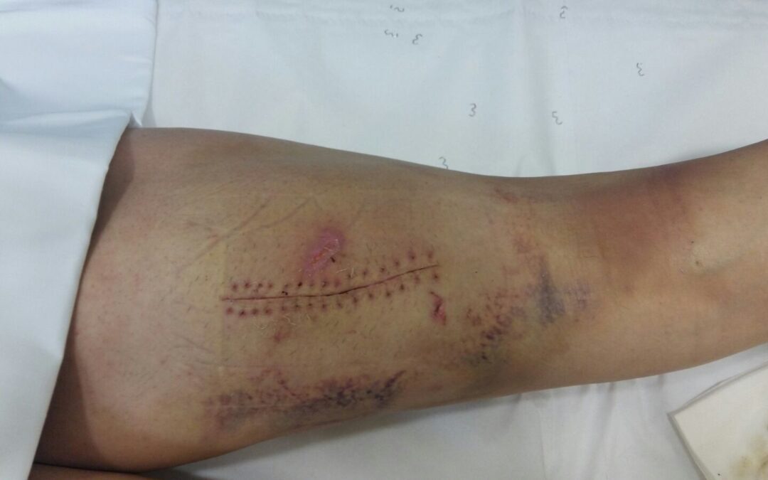 Ureña recibe el alta médica