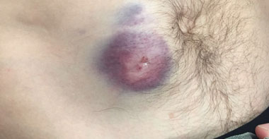 Eugenio de Mora, dado de alta