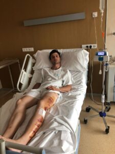 Tolete - Percance en el campo - Viernes 29 de junio de 2018