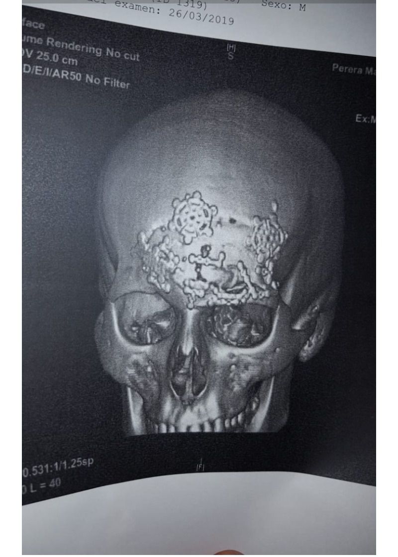 Un torero sin montera: el caso de Manuel Perera