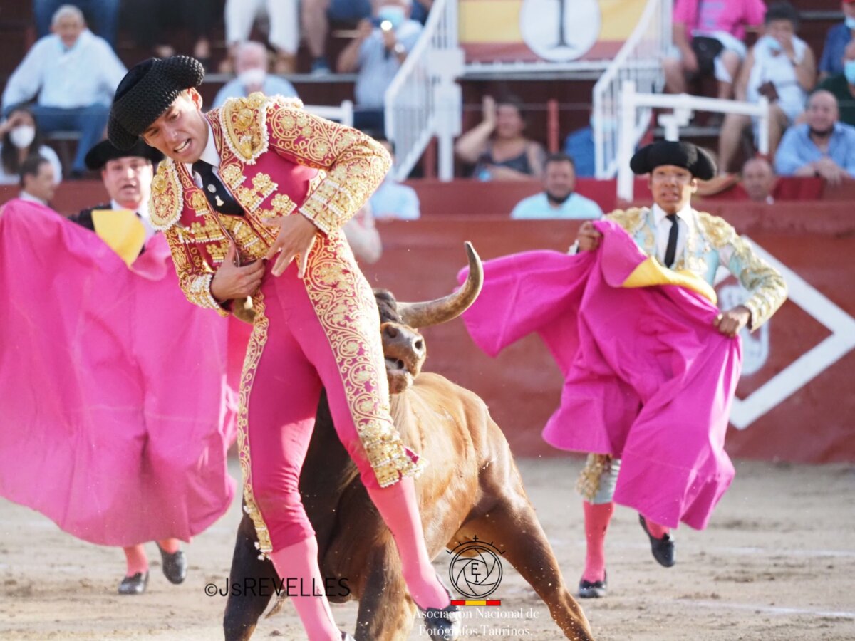 Borja collado, con luxación de hombro