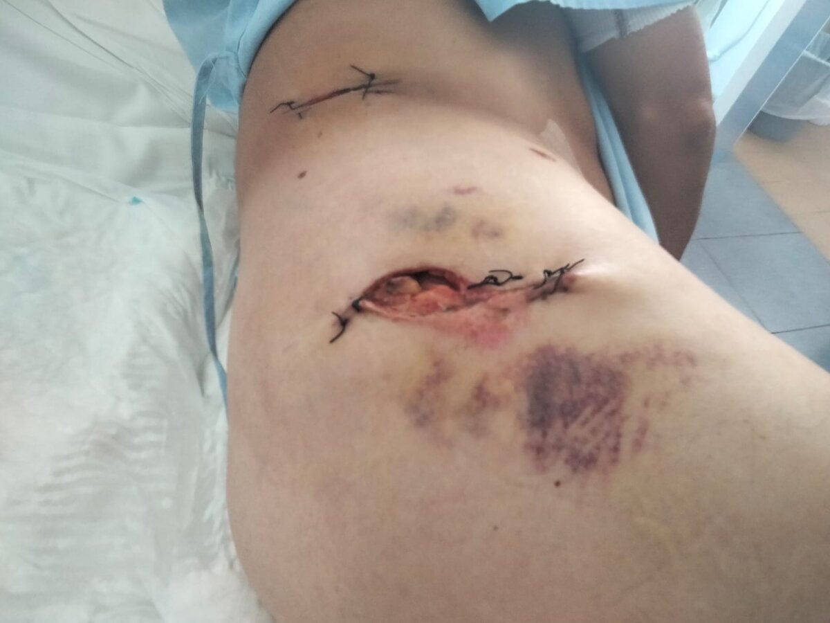 Enrique Martínez "Chapurra" recibe el alta hospitalaria