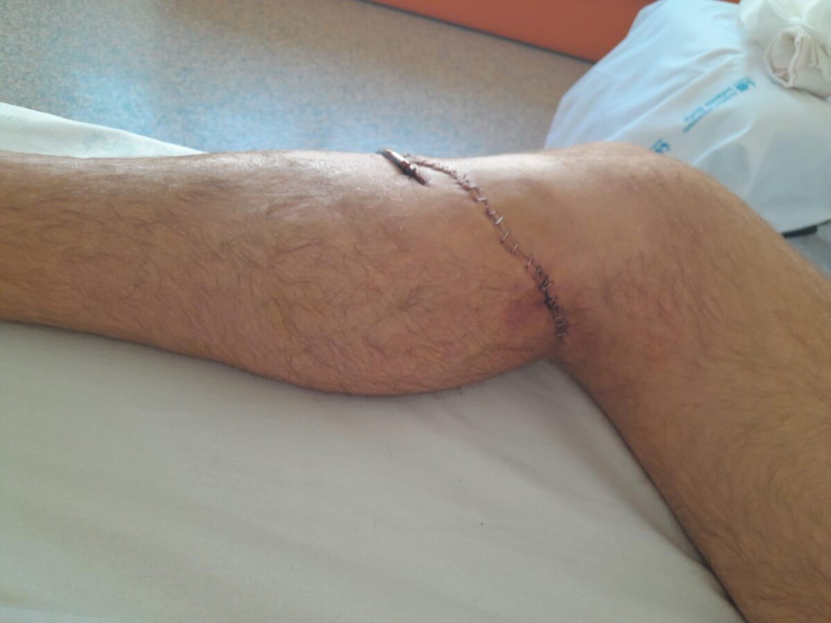 Joao d'Alva, trasladado a planta tras dos días en la UCI