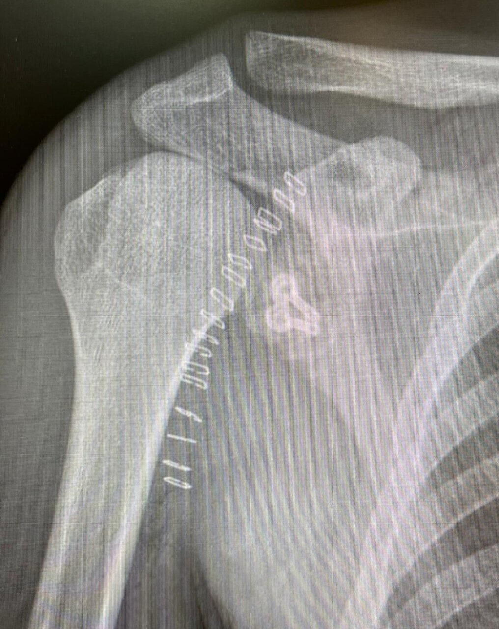 Tristán Barroso no podrá tomar la alternativa en Dax