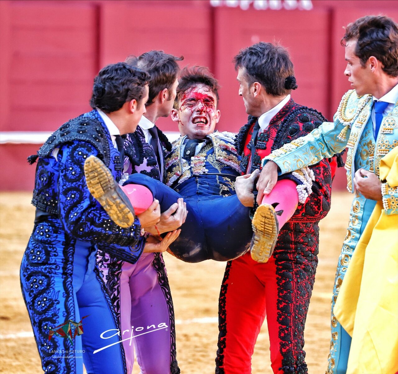 Alejandro Chicharro, "herida inciso contusa de 7, 15 y 12 centímetros en el muslo izquierdo"