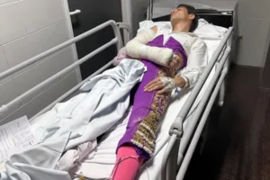 Trigueros, fractura de cúbito I IMAGEN: EL MULETAZO