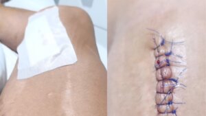 Imágenes compartidas por El Cid en sus redes sociales. Diseño de APLAUSOS.