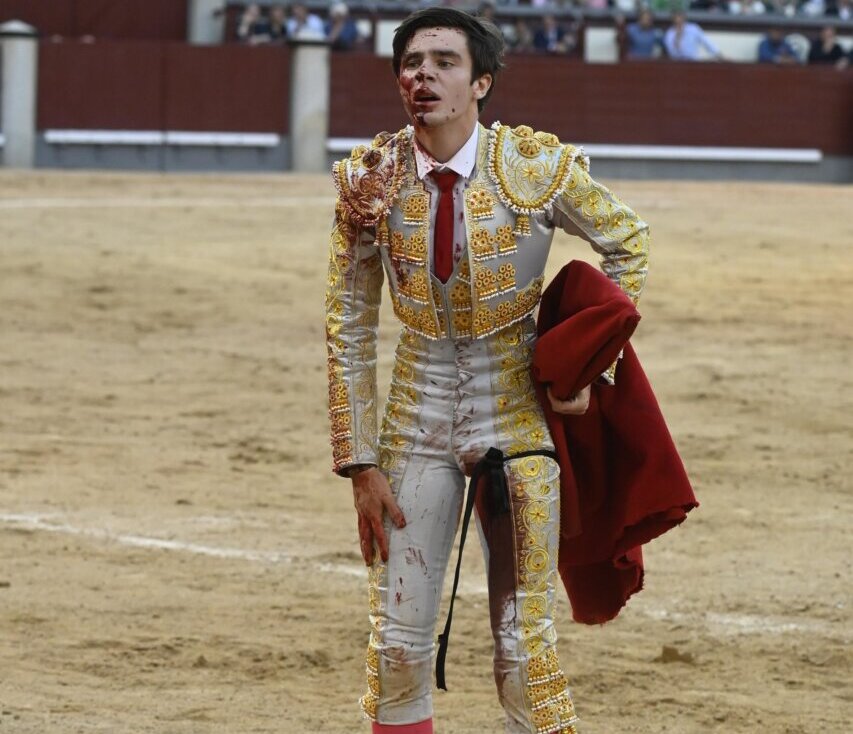 Mario Vilau, cornada de 15 cm que produce destrozo en músculo sartorio y contusiona arteria femoral