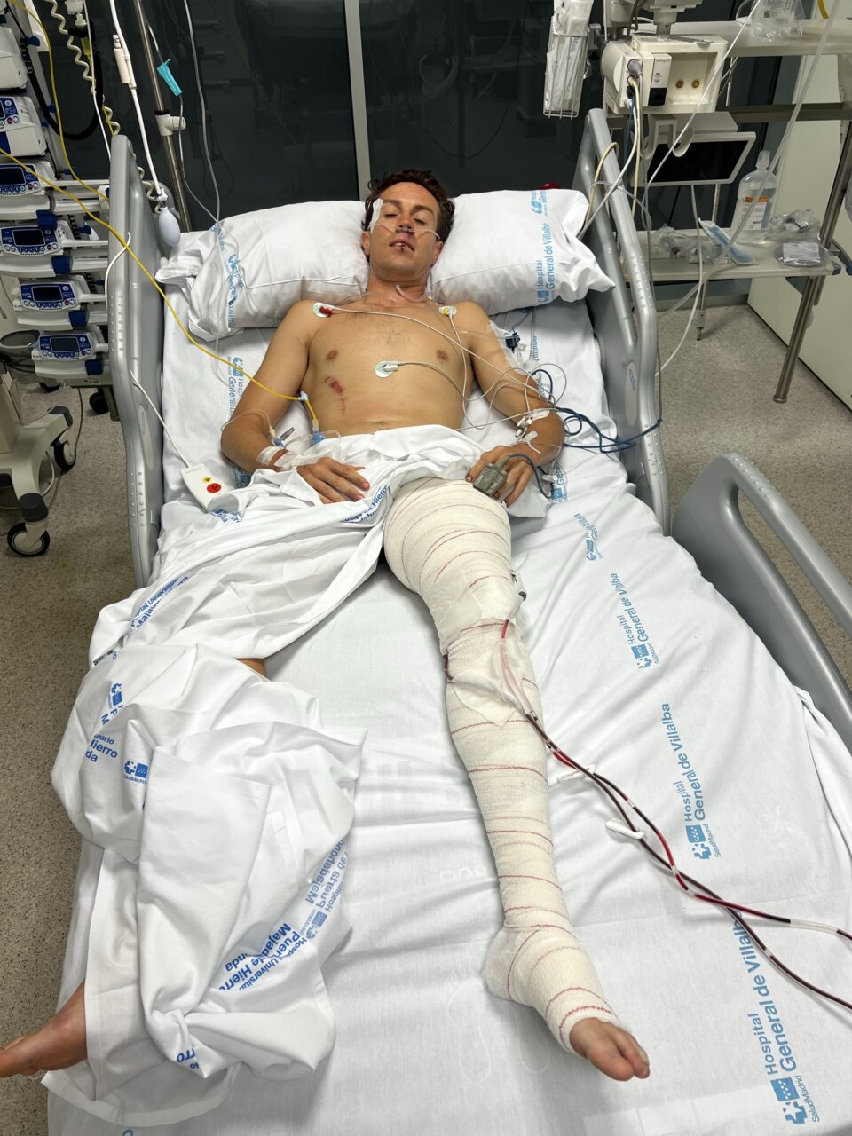 Tomás Angulo será intervenido por "riesgo de espasmo o trombosis" en su pierna izquierda